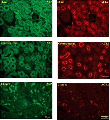 Effects of Angiotensin II Type 1A Receptor on ACE2, Neprilysin and KIM-1 in Two Kidney One Clip (2K1C) Model of Renovascular Hypertension